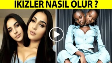 Yapışık İkizler Nasıl Yaşar Nasıl Ölürler?